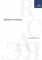 Arritmias cardíacas