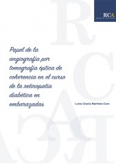 Papel de la angiografía por tomografía óptica de coherencia en el curso de la retinopatía diabética en embarazadas